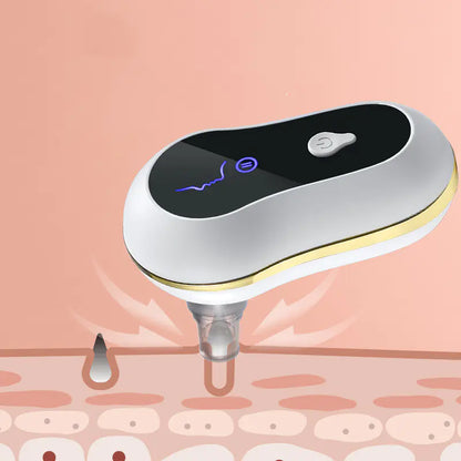 Electric Blackhead Remover with Ultrasonic Technology