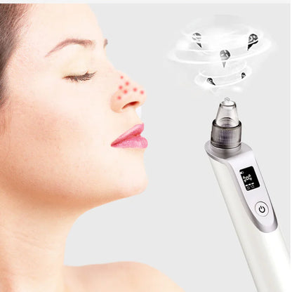 Pore Cleanser Ultrasonic Blackhead Remover Device
