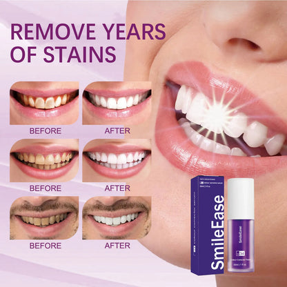 Purple Teeth Whitening Toothpaste Bottle