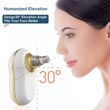 Electric Blackhead Remover with Ultrasonic Technology